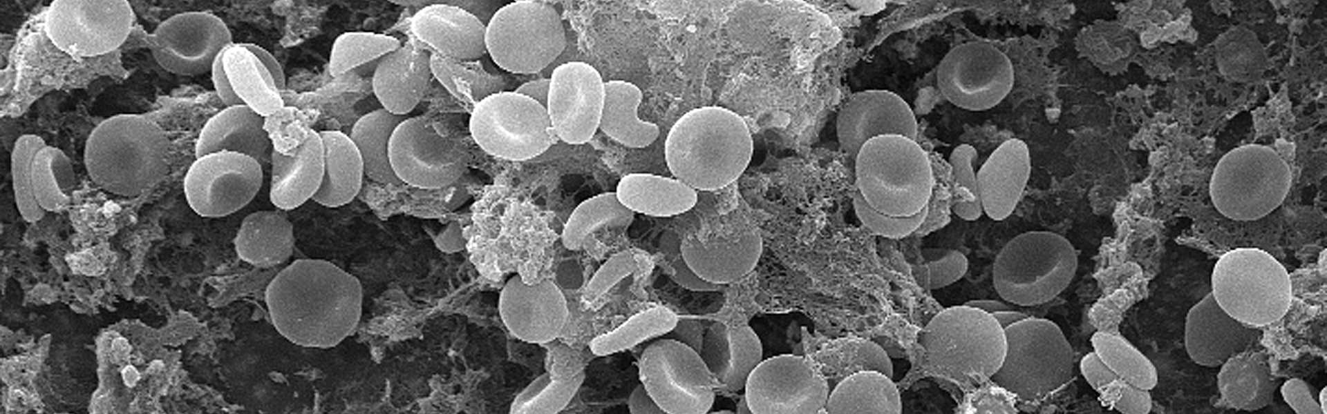 MAP E.coli Protein